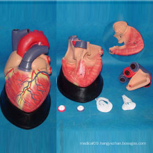 Human Heart Anatomy Medical Model for Teaching (R120102)